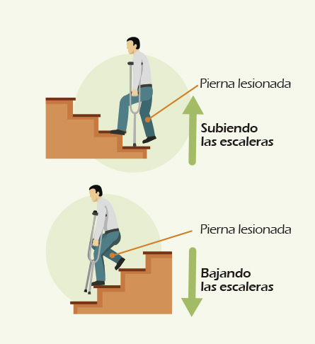 subir-bajar-escalera Servicio de Rehabilitación