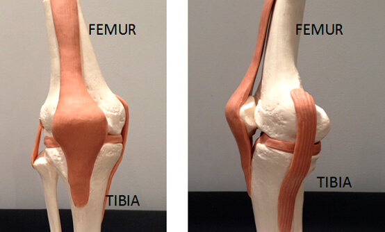 figura1 Reemplazo total de rodilla